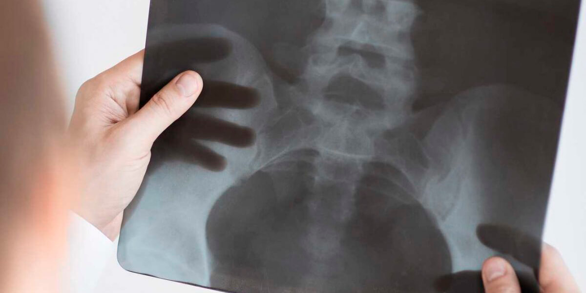 Radiology: X-Rays