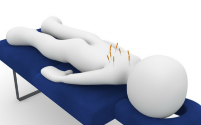 How Acupuncture Helps Our Patients With Chronic Pain