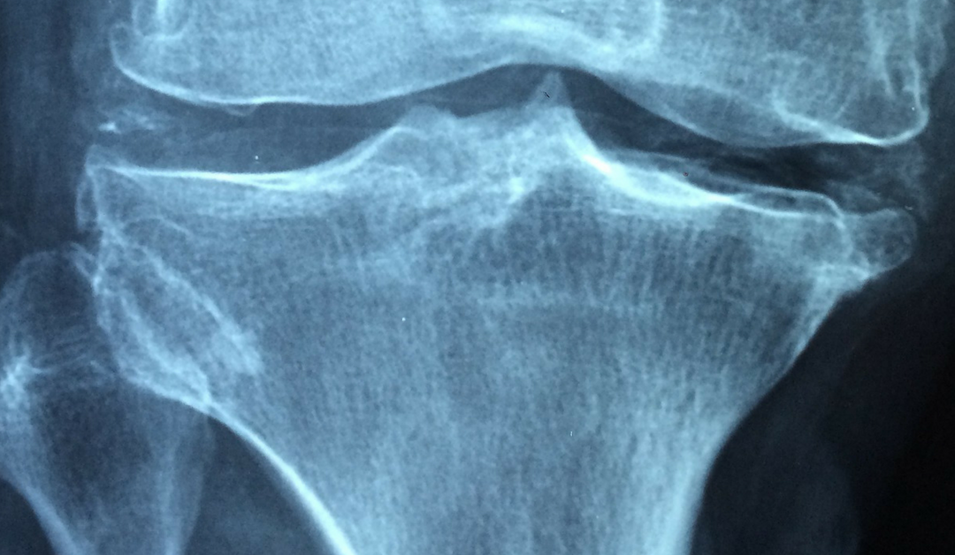 Do Your Physicians Perform Bone Density Checks?