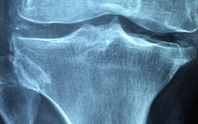 Do Your Physicians Perform Bone Density Checks?